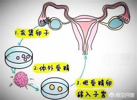 深圳试管婴儿成功率怎么看：用规范口径替代固定承诺